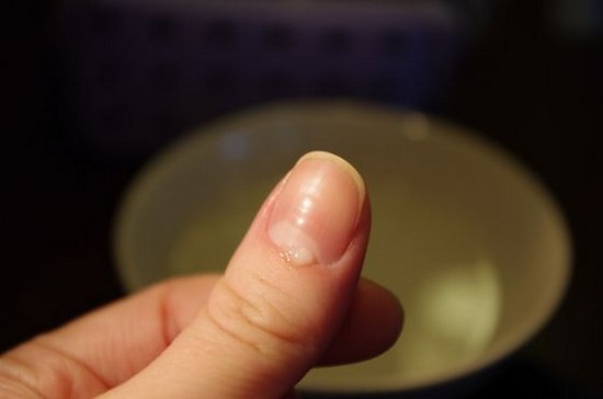 Enlèvement des cuticules