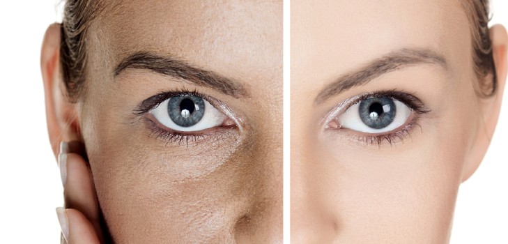 Comment lisser le visage? Corrigez les recommandations!