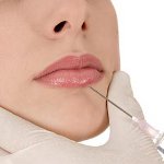 Contour en plastique