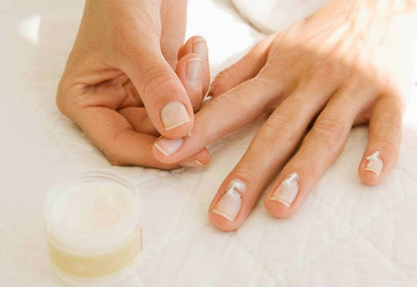 Cinq problèmes d'ongles fréquents: causes et solutions