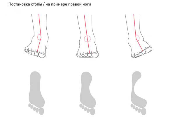 Comment choisir les bonnes chaussures