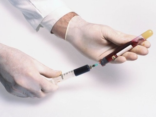 Analyses pour antimulylerov une hormone