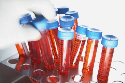 Analyses pour antimulylerov une hormone