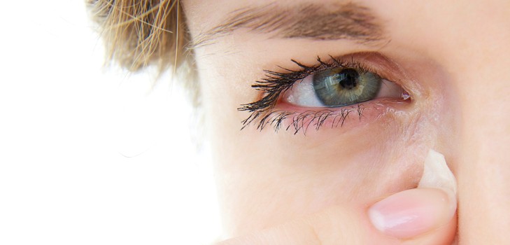 Que faire si ça démange dans les coins des yeux