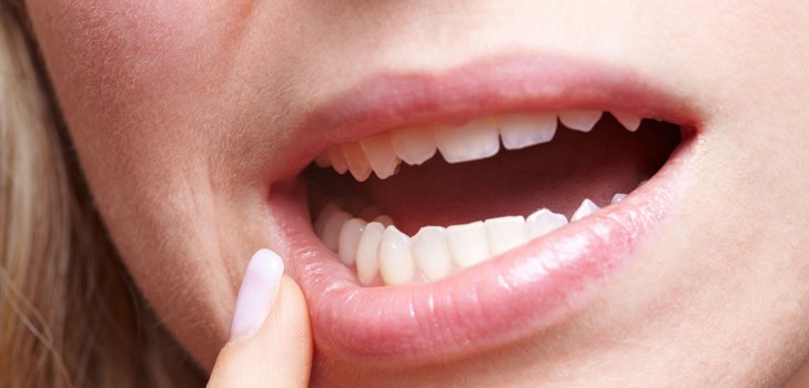 Pourquoi démange-t-il les dents chez un adulte