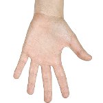 Comment se débarrasser des verrues sur vos mains