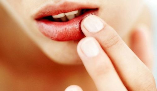  Un moyen rapide et efficace de traiter les rhumes sur les lèvres: des recettes simples