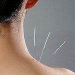 Traitement avec l'acupuncture