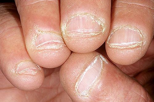 Comment reconnaître et que faire en cas de troubles métaboliques
